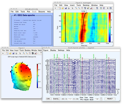 EEGLAB